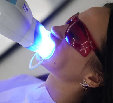 Advantages-of-Teeth-Whitening