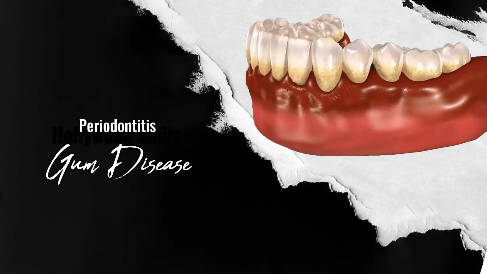 Periodontology in IstanbulTurkey