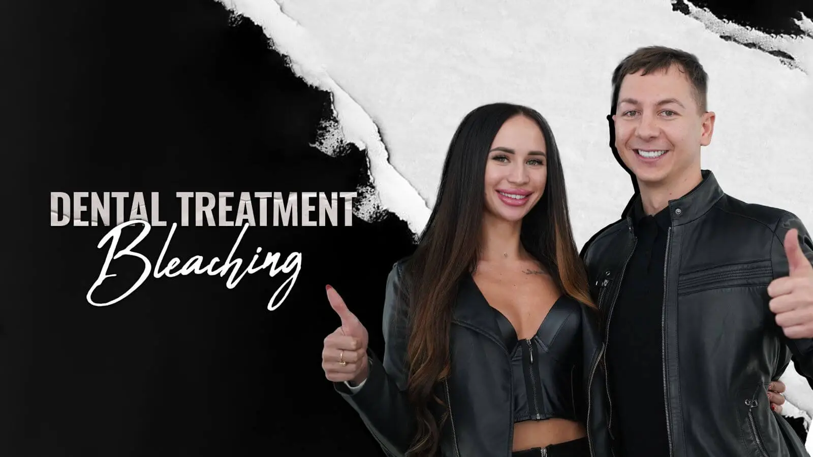 Teeth Whitening in istanbulTurkey