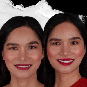before-after-Digital-Smile-Design-6
