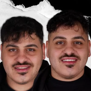 before-after-Teeth-Whitening-6