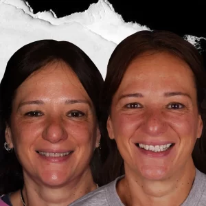 before-after-Teeth-Whitening-8