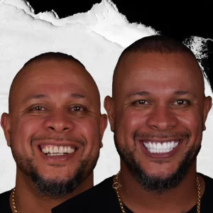 before-after-periodontology-3