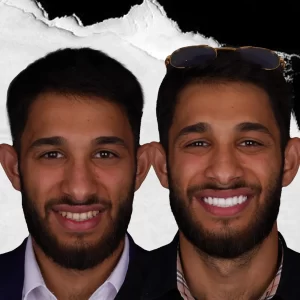 before-after-periodontology-7