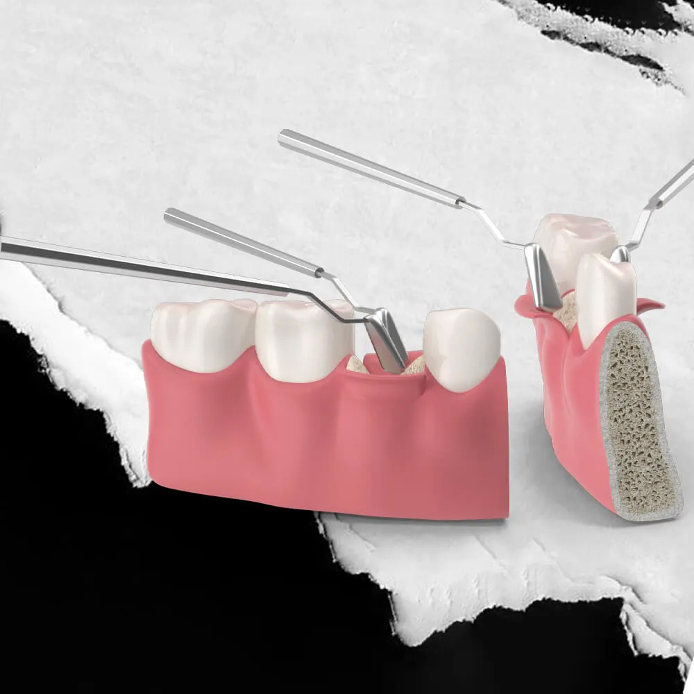 endodoncie