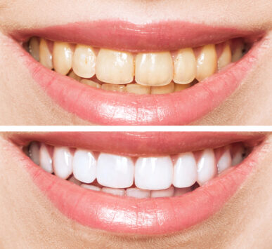 Depositphotos_332220136_XL
